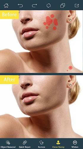 Photo Retouch- Object Removal Ảnh chụp màn hình 2