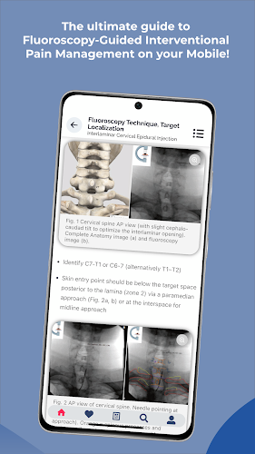 Interventional Pain App屏幕截圖4