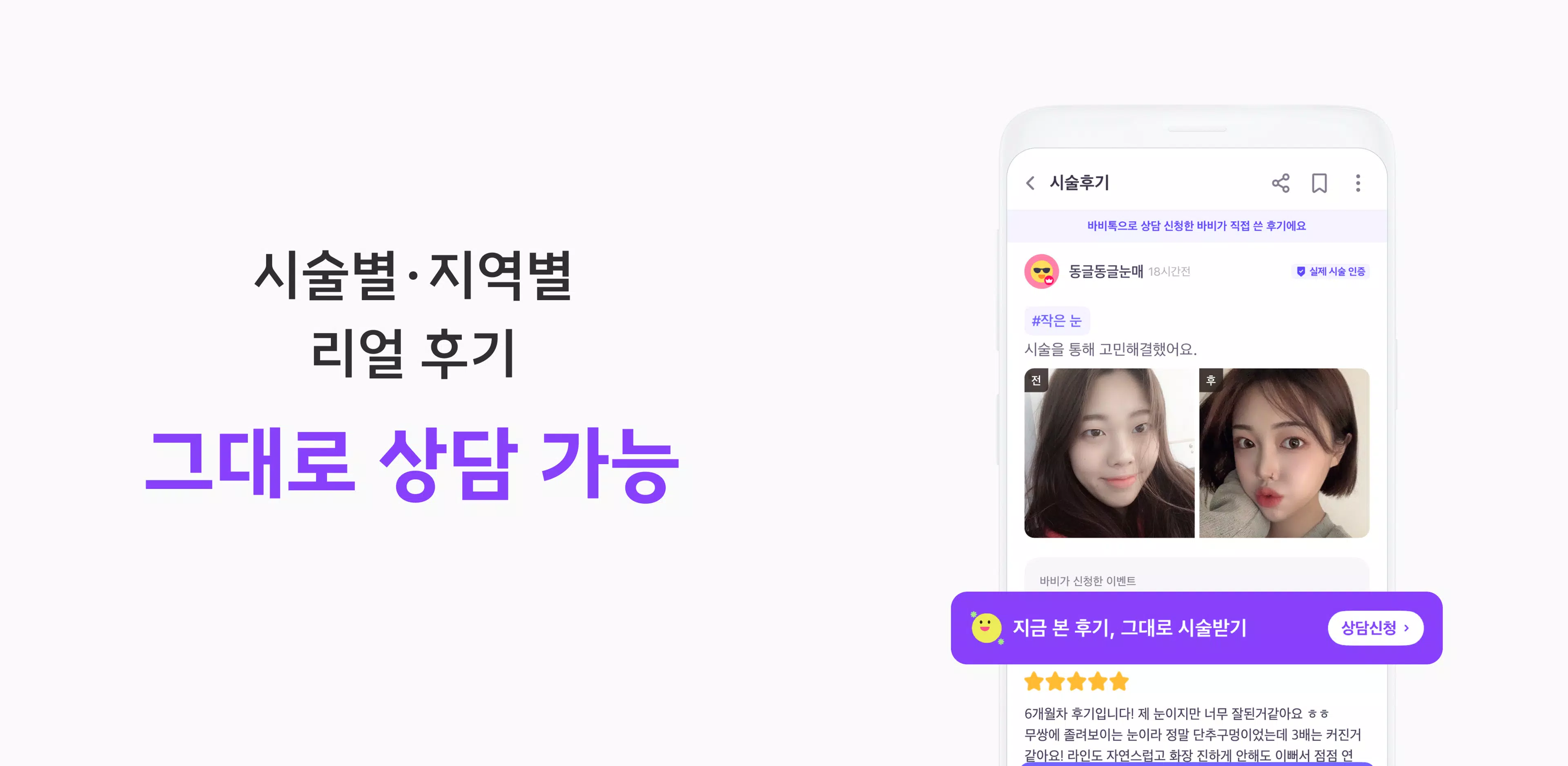 Screenshot 바비톡 - 성형 시술 성형외과 피부과 병원예약 성형어플 3