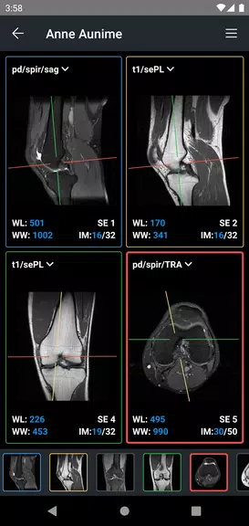 IDV - IMAIOS DICOM Viewer Screenshot 3