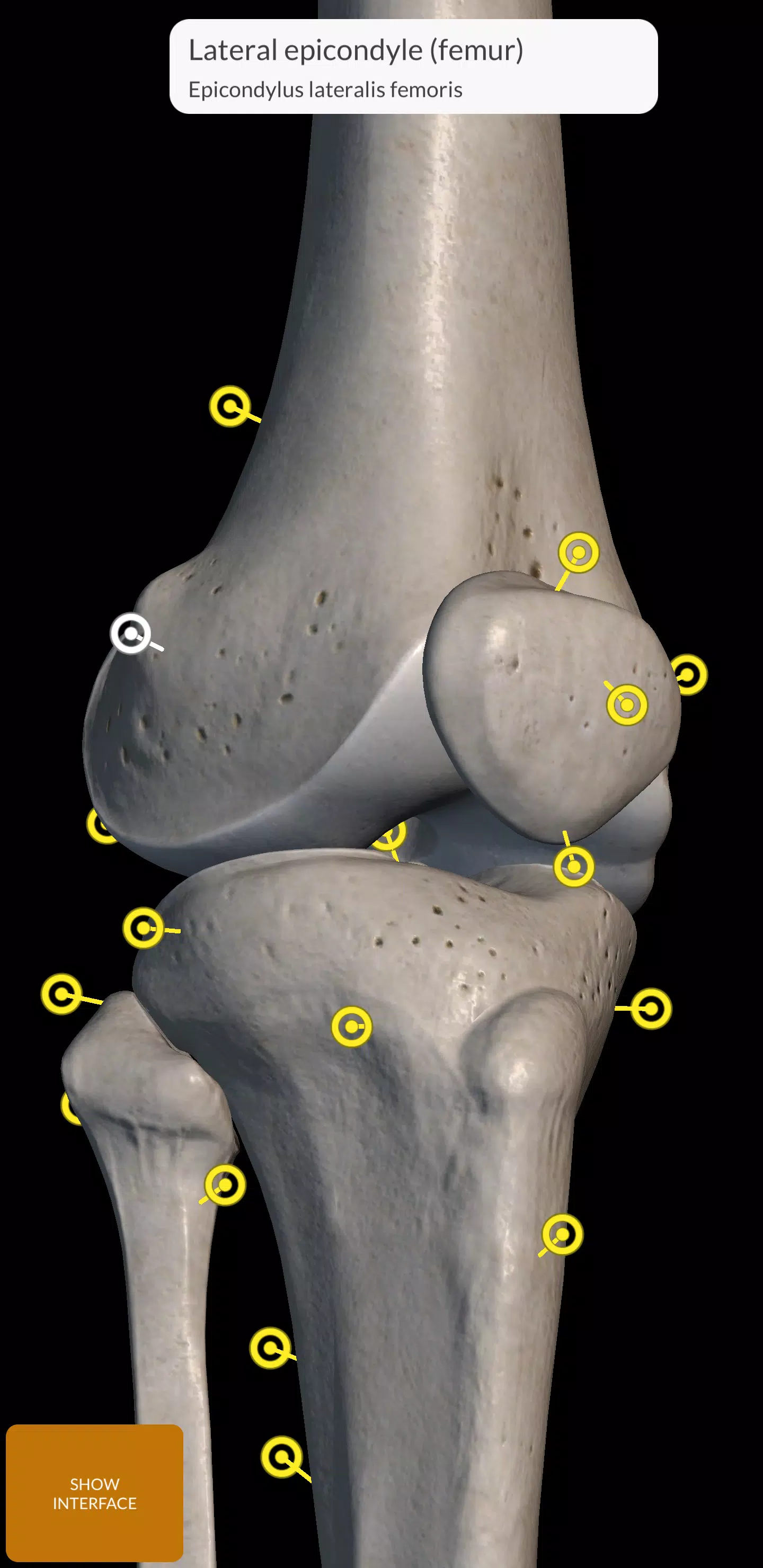 Skeleton ảnh chụp màn hình 3