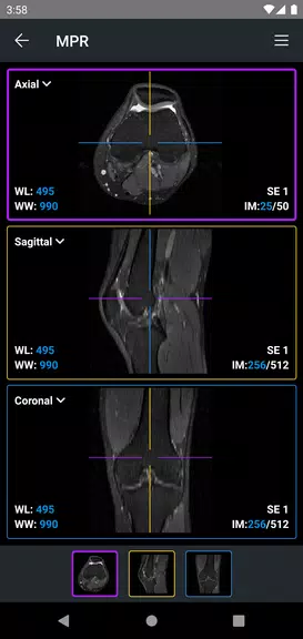 IDV - IMAIOS DICOM Viewer Screenshot 4