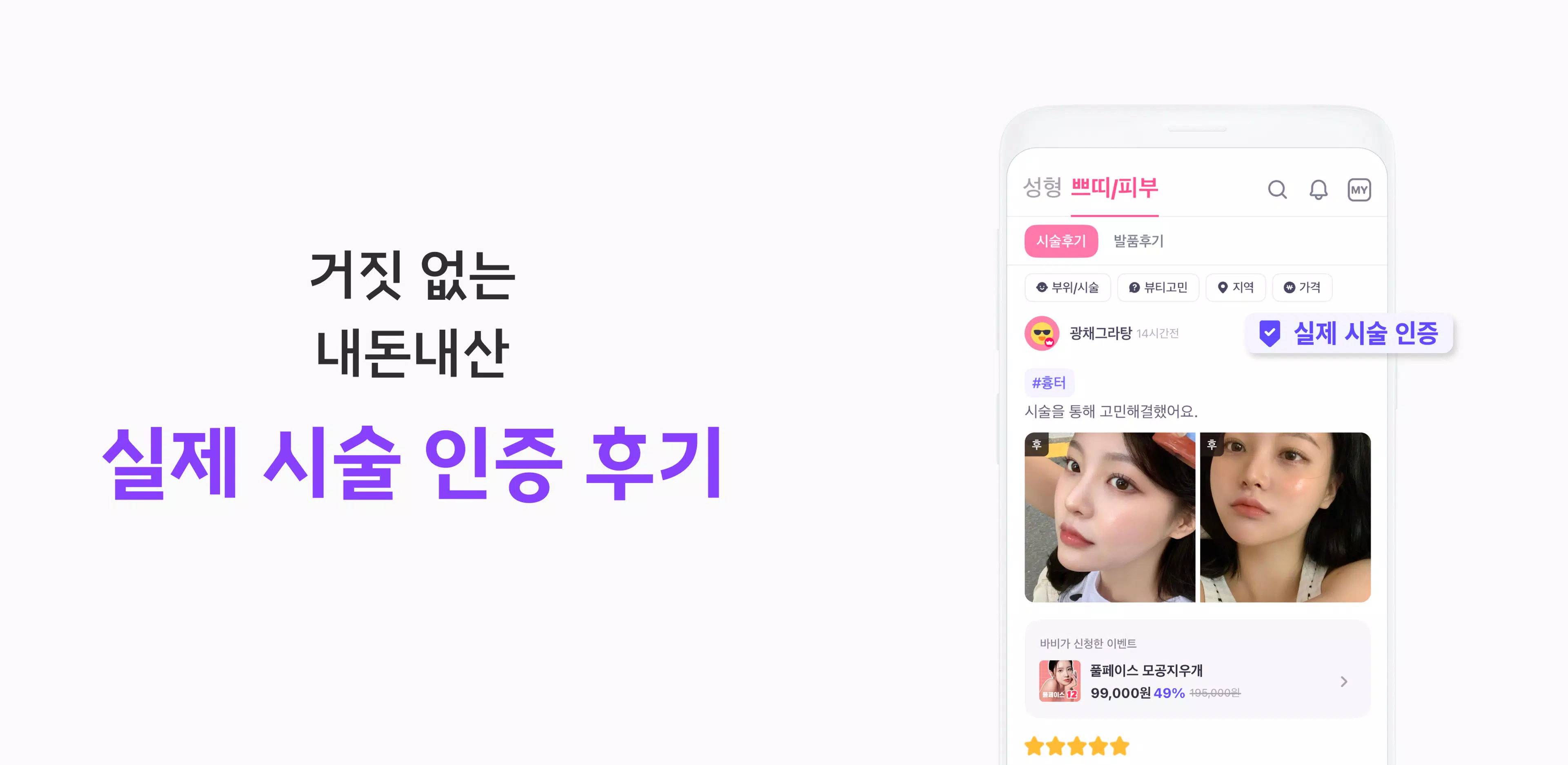 Screenshot 바비톡 - 성형 시술 성형외과 피부과 병원예약 성형어플 2