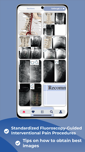 Interventional Pain App屏幕截圖3